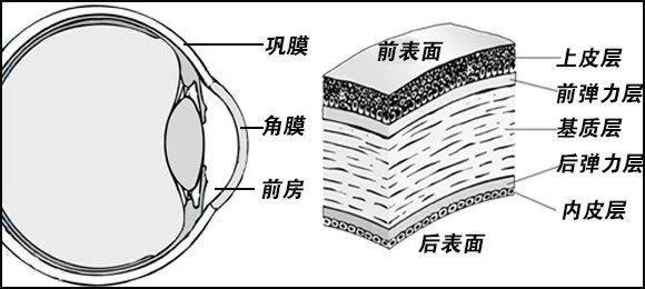 角膜薄可以做激光手術吗,角膜薄可以做ICL吗
